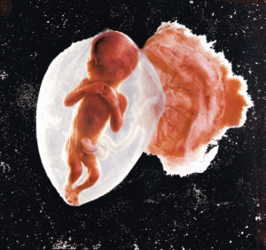 un feto di 18 settimane foto di Lennart Nilsson, 1965